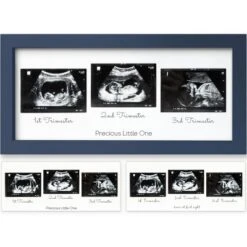 KeaBabies Trio Baby Sonogram Picture Frame, Baby Ultrasound Picture Frames For Baby Nursery, Mom To Be Gifts 23 KeaBabies Trio Baby Sonogram Picture Frame, Baby Ultrasound Picture Frames For Baby Nursery, Mom To Be Gifts -Home Shop GUEST 0d39649d 6126 4bba b217 1b917313aa7c
