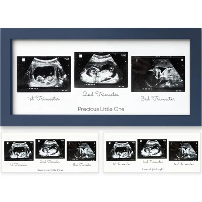 KeaBabies Trio Baby Sonogram Picture Frame, Baby Ultrasound Picture Frames For Baby Nursery, Mom To Be Gifts 13 KeaBabies Trio Baby Sonogram Picture Frame, Baby Ultrasound Picture Frames For Baby Nursery, Mom To Be Gifts - Image 11