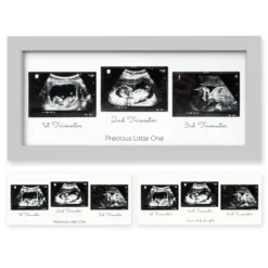 KeaBabies Trio Baby Sonogram Picture Frame, Baby Ultrasound Picture Frames For Baby Nursery, Mom To Be Gifts 22 KeaBabies Trio Baby Sonogram Picture Frame, Baby Ultrasound Picture Frames For Baby Nursery, Mom To Be Gifts -Home Shop GUEST 3bf25d41 c634 498c 84e3 c83dfec65ad0