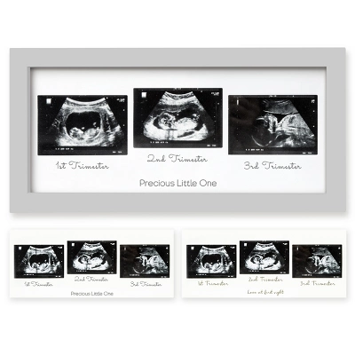 KeaBabies Trio Baby Sonogram Picture Frame, Baby Ultrasound Picture Frames For Baby Nursery, Mom To Be Gifts 12 KeaBabies Trio Baby Sonogram Picture Frame, Baby Ultrasound Picture Frames For Baby Nursery, Mom To Be Gifts - Image 10