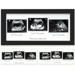KeaBabies Trio Baby Sonogram Picture Frame, Baby Ultrasound Picture Frames For Baby Nursery, Mom To Be Gifts 21 KeaBabies Trio Baby Sonogram Picture Frame, Baby Ultrasound Picture Frames For Baby Nursery, Mom To Be Gifts -Home Shop GUEST 692bd1b8 56a8 4616 9d57 d9c4204c1c6d