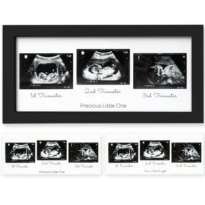 KeaBabies Trio Baby Sonogram Picture Frame, Baby Ultrasound Picture Frames For Baby Nursery, Mom To Be Gifts 11 KeaBabies Trio Baby Sonogram Picture Frame, Baby Ultrasound Picture Frames For Baby Nursery, Mom To Be Gifts - Image 9