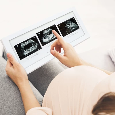 KeaBabies Trio Baby Sonogram Picture Frame, Baby Ultrasound Picture Frames For Baby Nursery, Mom To Be Gifts 3 KeaBabies Trio Baby Sonogram Picture Frame, Baby Ultrasound Picture Frames For Baby Nursery, Mom To Be Gifts